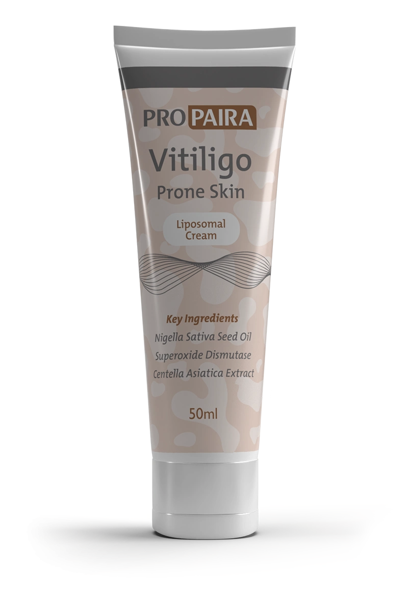 Vitiligo Treatment by Propaira - Vitiligo Gel