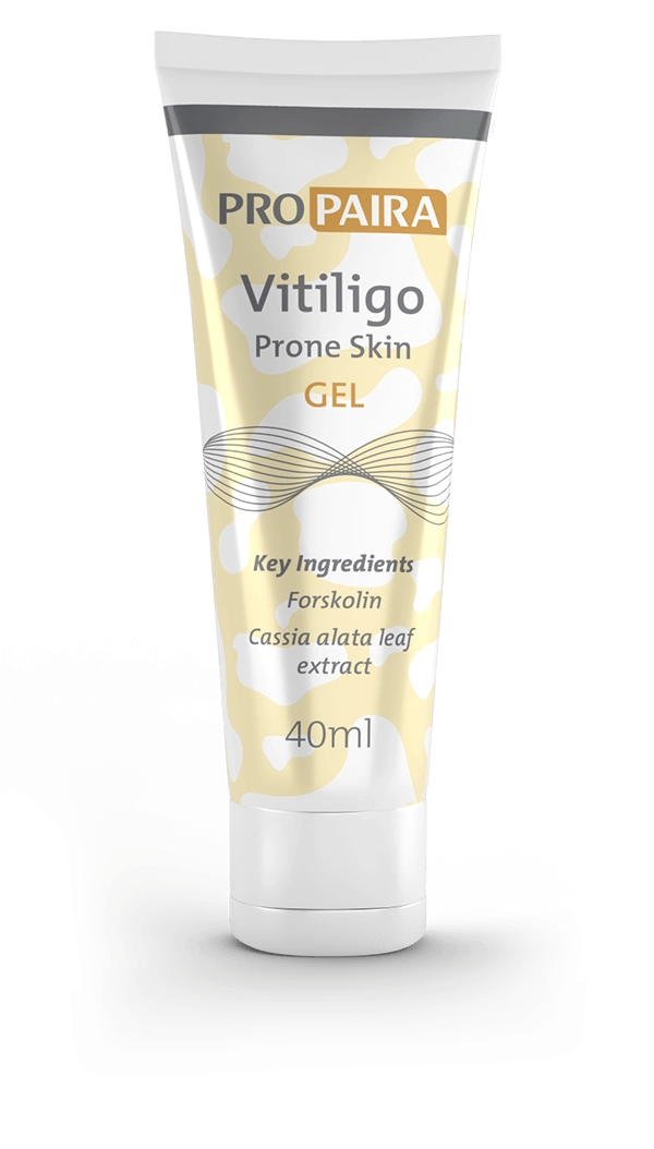 Vitiligo Treatment by Propaira - Vitiligo Gel