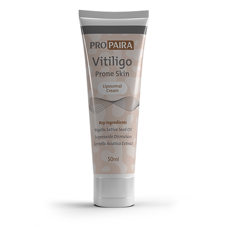 Vitiligo Prone Skin Liposomal Cream 50ml for re-pigmentation of the skin